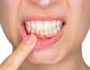 Zahnfleischbehandlungen (Parodontologie)