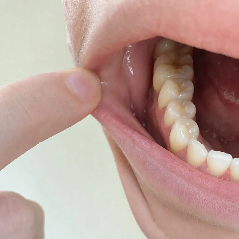Example left side dental photo