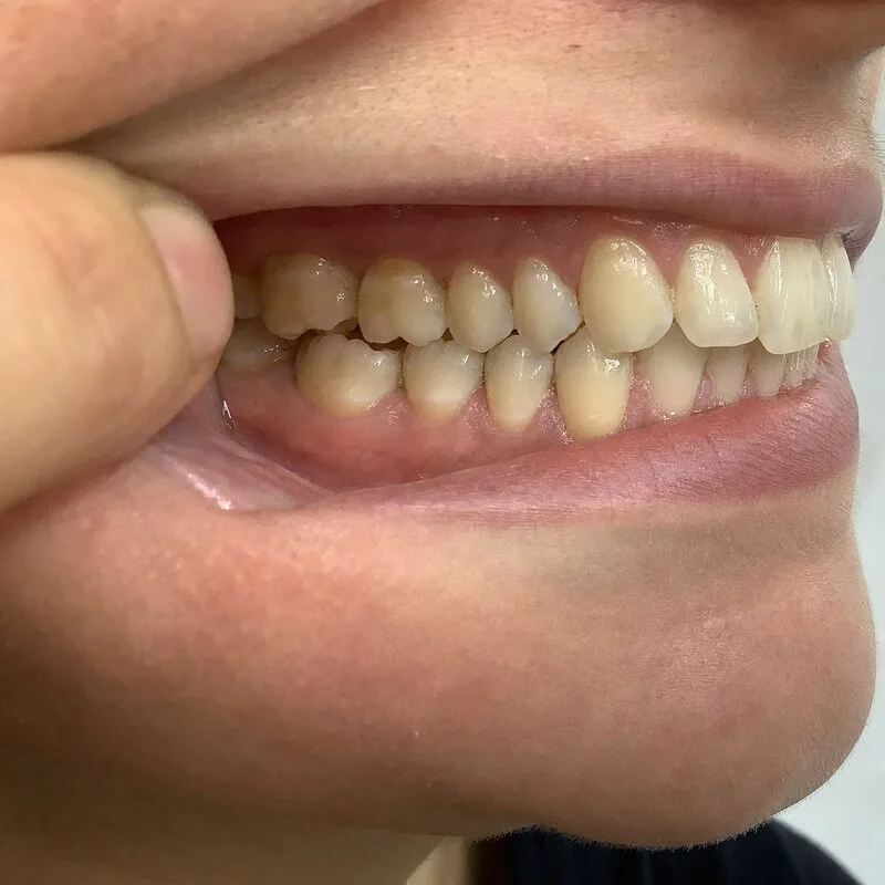 Example right side dental photo